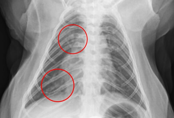 画像：X線写真で肺炎を確認